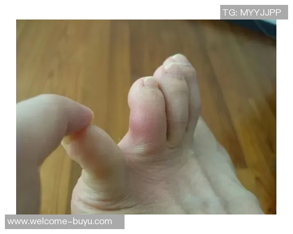 加兰左脚大脚趾再度受伤复查结果将影响未来比赛安排